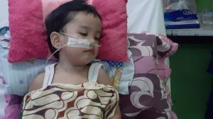 Tumor Ganas Serang Otak Alesya, Bocah 4 Tahun Ini Butuh Bantuan