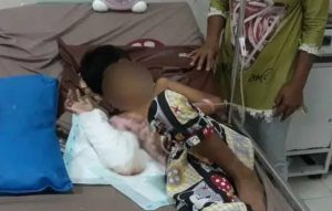 Gila! Ayah Tiri Diduga Bakar Anaknya, Korban Selamat
