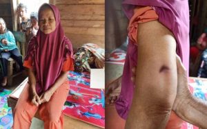 Sedang Menyadap Karet, Warga Merangin Diserang Harimau