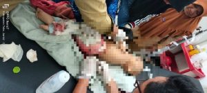 Seorang Ibu di Tebo Tega Bacok Anaknya yang Masih Bocah
