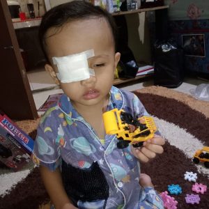 Shakel Balita Penderita Mata Akut,Butuh Uluran Dermawan Untuk Biaya Operasi