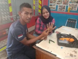 Minta Bantuan Petugas Damkar, Cincin Warga Tak Bisa Lepas Jarinya Bengkak